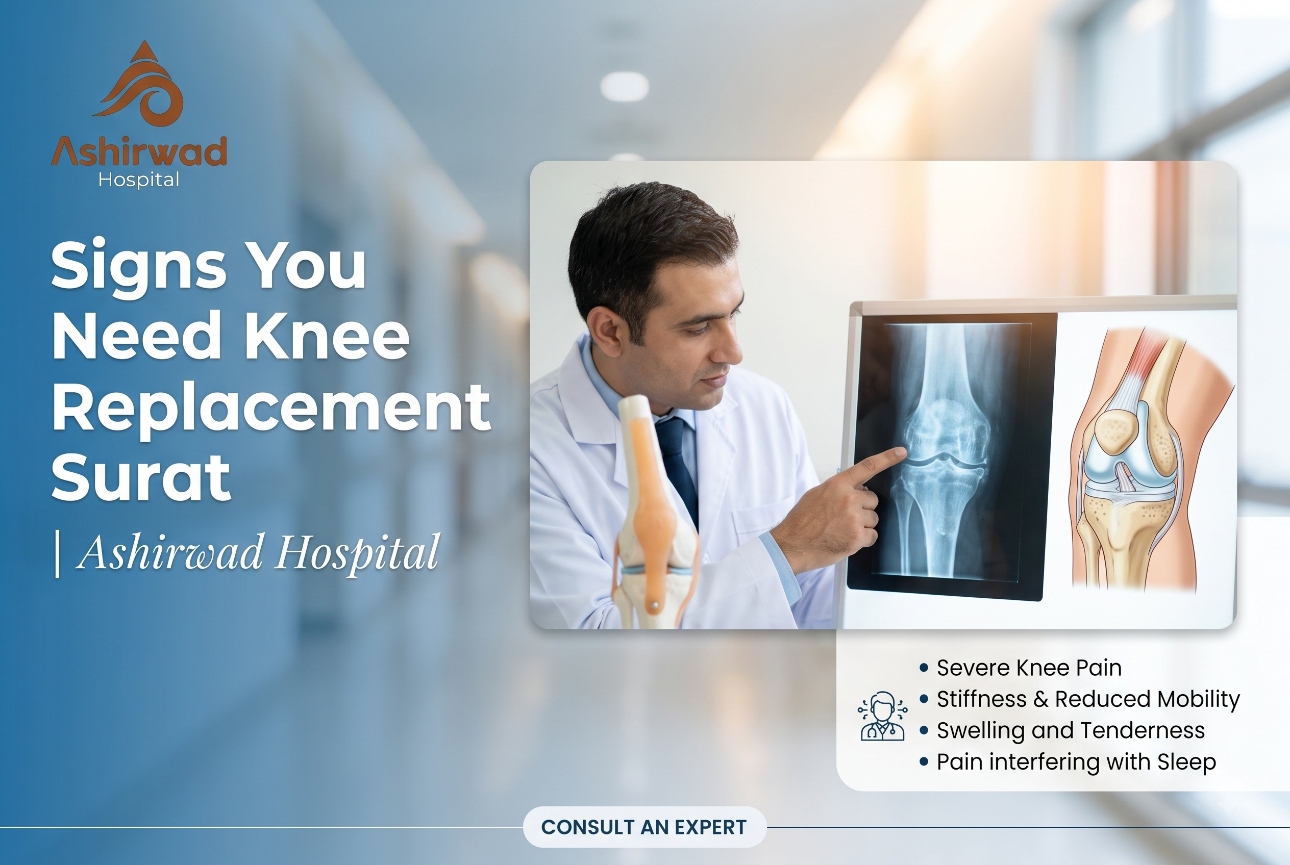 Signs You Need Knee Replacement Surat | Ashirwad Hospital
