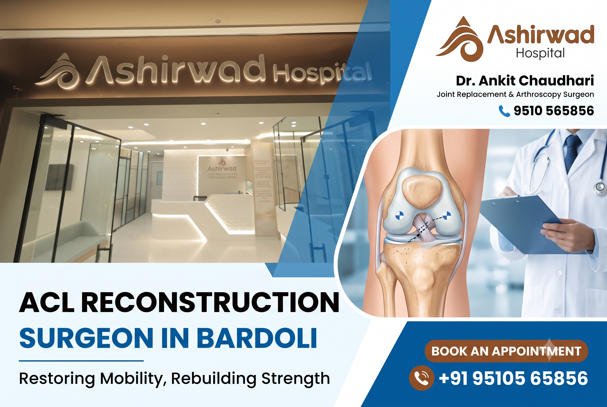 Acl Reconstruction Doctor Surgeon in Bardoli
